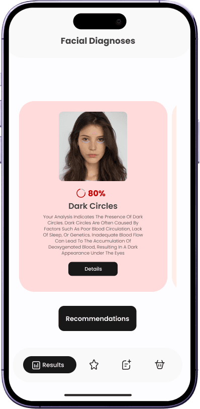 Image showing a facial analysis indicating the presence of dark circles under the eyes.